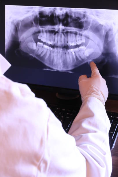 Best Dentist for Tooth Abscess  in Martinsville, NJ