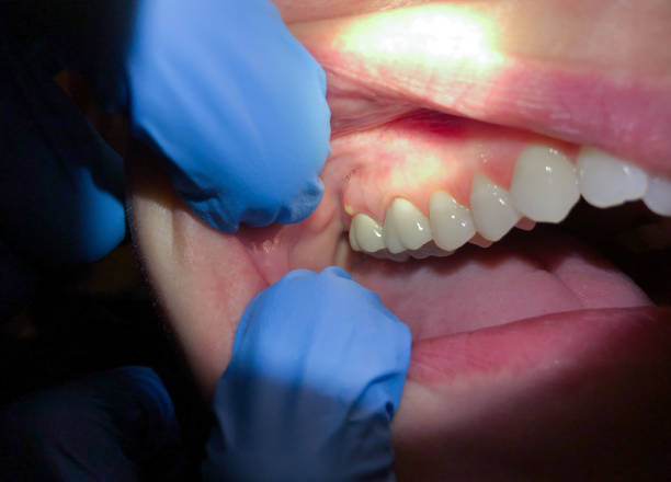 Best Emergency Dentist Near Me  in Martinsville, NJ
