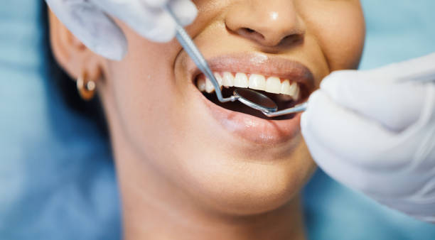 Best Root Canal Emergency Dentist  in Martinsville, NJ